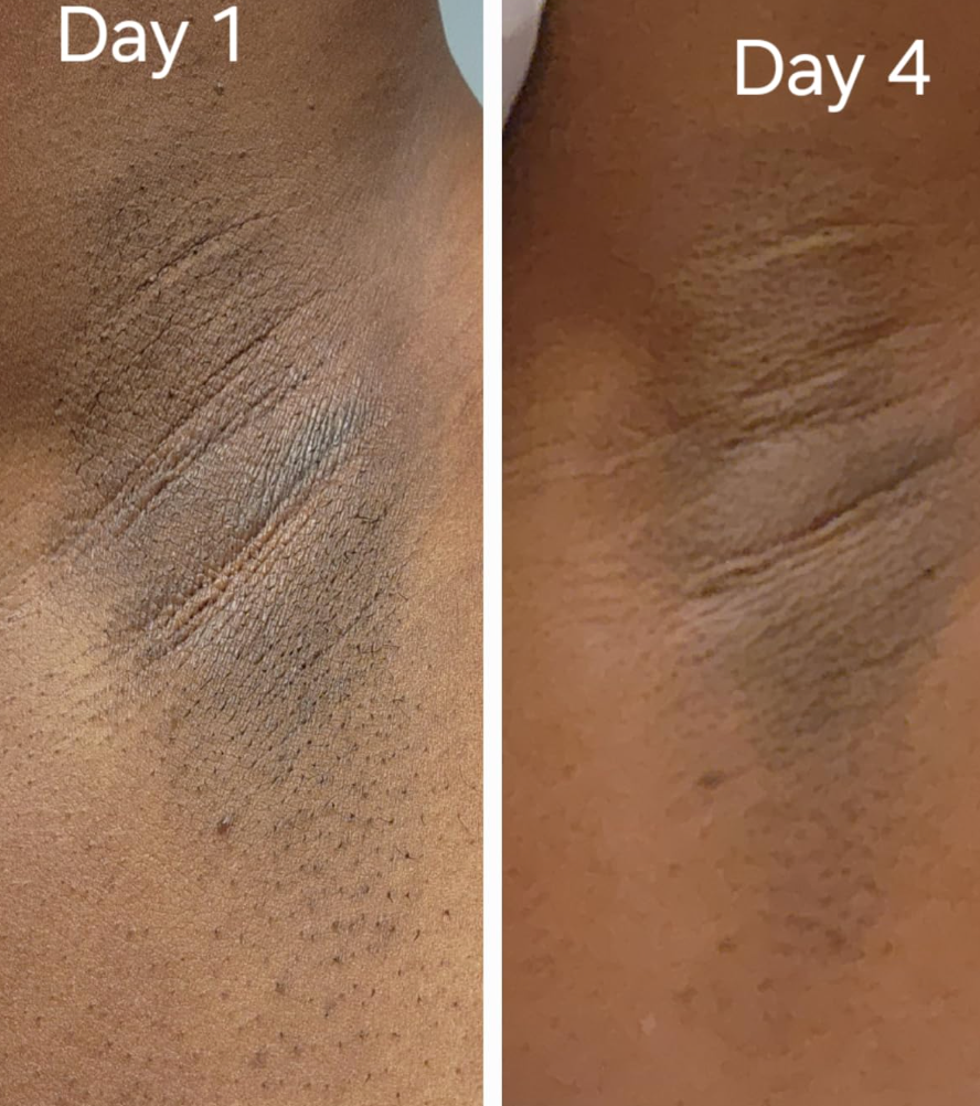 Rejuvenating Yoni Oil