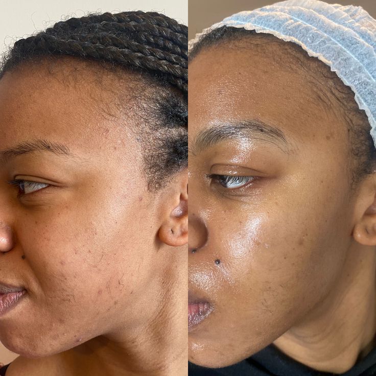 After using product