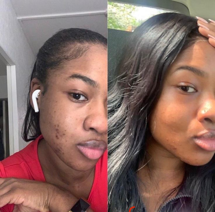 After using product