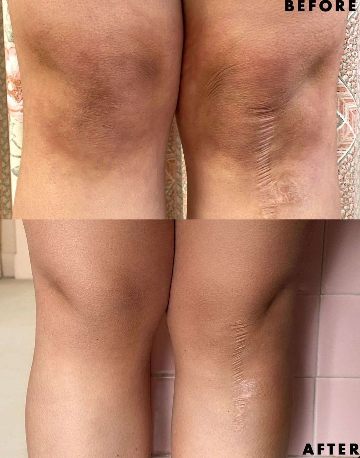 Turmeric Exfoliating Scrub