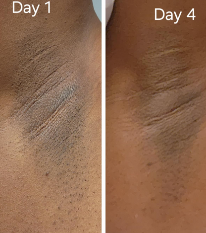 Rejuvenating Yoni Oil